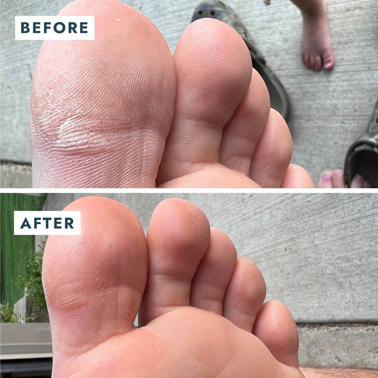 Heel Repair Duo - Mint