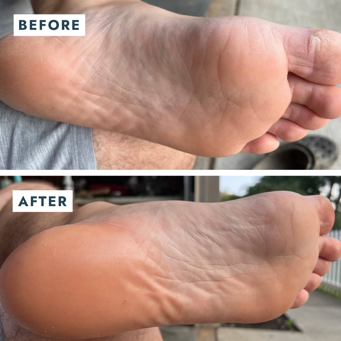 Heel Repair Duo - Mint