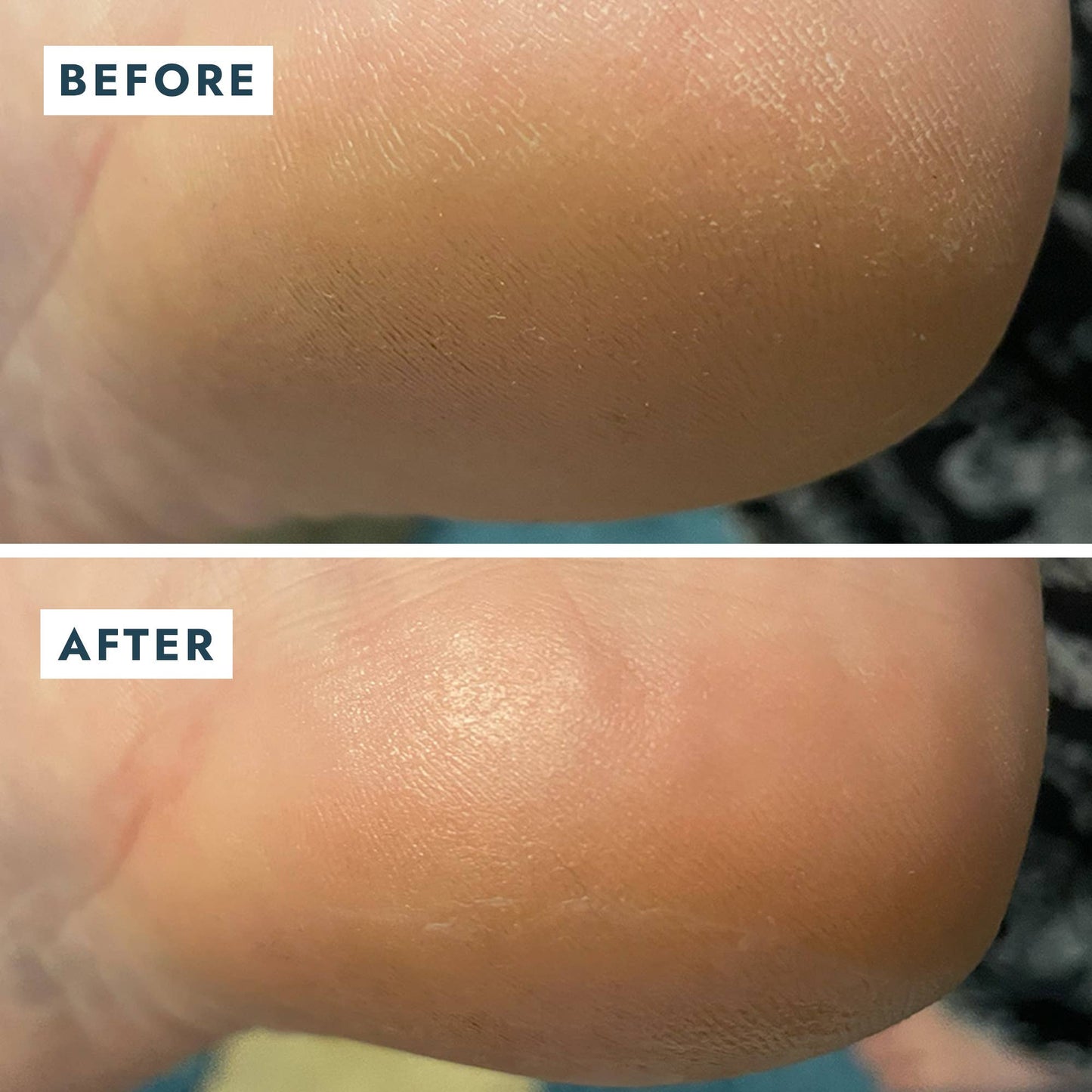 Heel Repair Duo - Mint