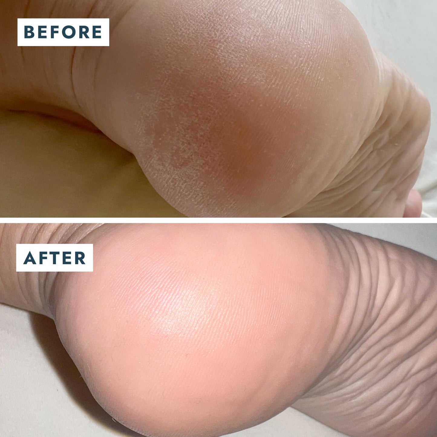 Heel Repair Duo - Mint