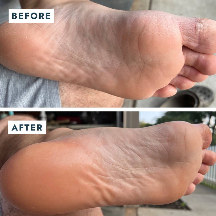 Heel Repair Duo - Mint